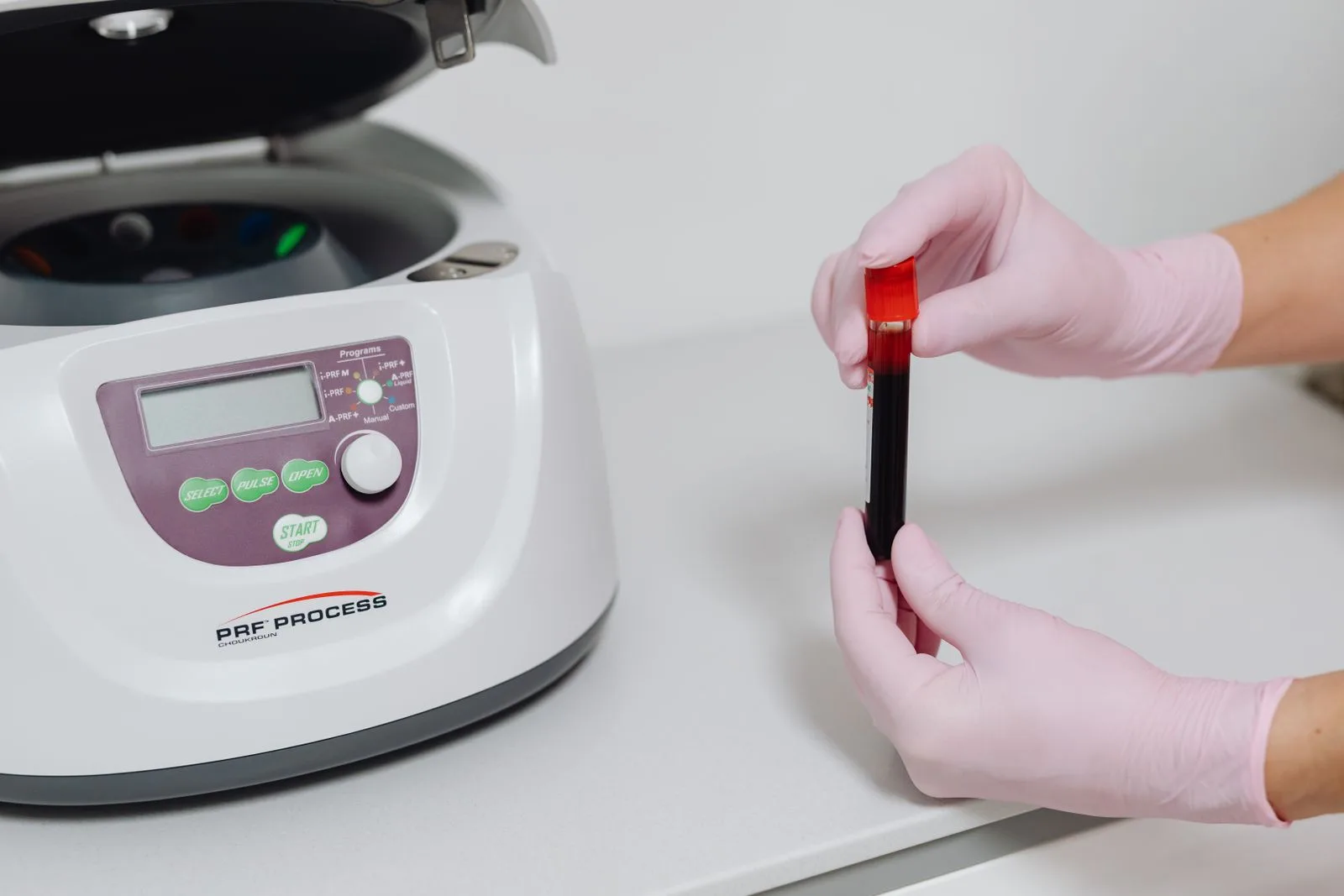 Gloved hands holding a blood sample beside a centrifuge for PRP hair treatment in Malta